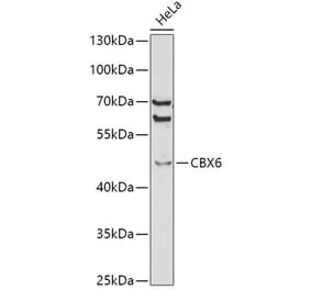 Western Blot - Anti-Cbx6 Antibody (A14823) - Antibodies.com