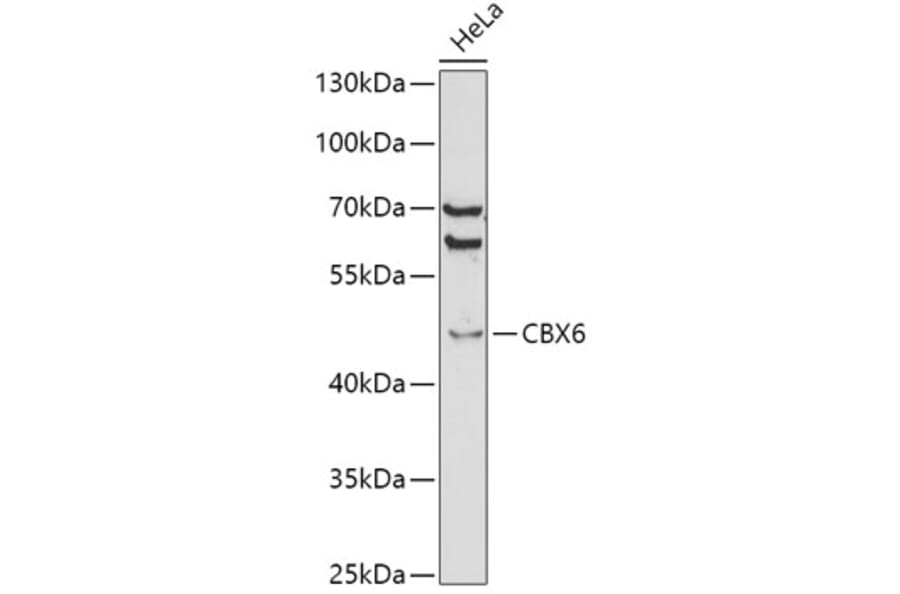 Western Blot - Anti-Cbx6 Antibody (A14823) - Antibodies.com