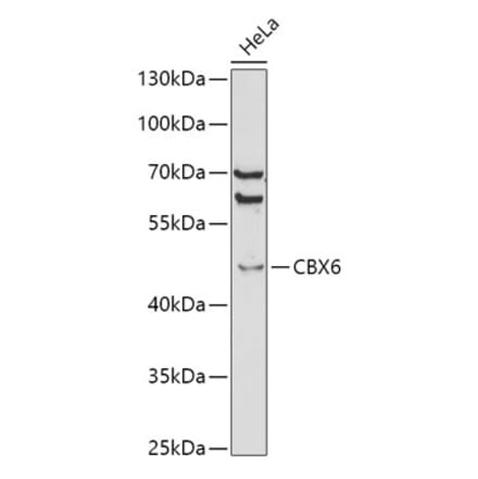 Western Blot - Anti-Cbx6 Antibody (A14823) - Antibodies.com