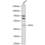 Western Blot - Anti-Cbx6 Antibody (A14823) - Antibodies.com