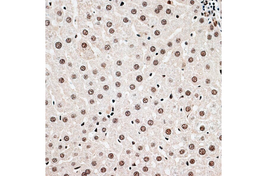 Immunohistochemistry - Anti-Cbx6 Antibody (A14823) - Antibodies.com