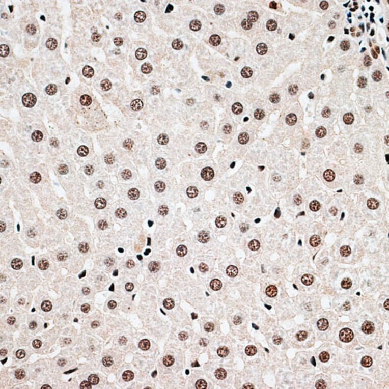 Immunohistochemistry - Anti-Cbx6 Antibody (A14823) - Antibodies.com