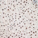 Immunohistochemistry - Anti-Cbx6 Antibody (A14823) - Antibodies.com