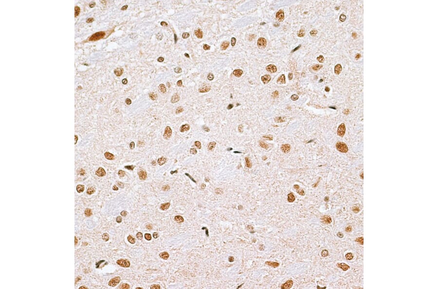 Immunohistochemistry - Anti-Cbx6 Antibody (A14823) - Antibodies.com