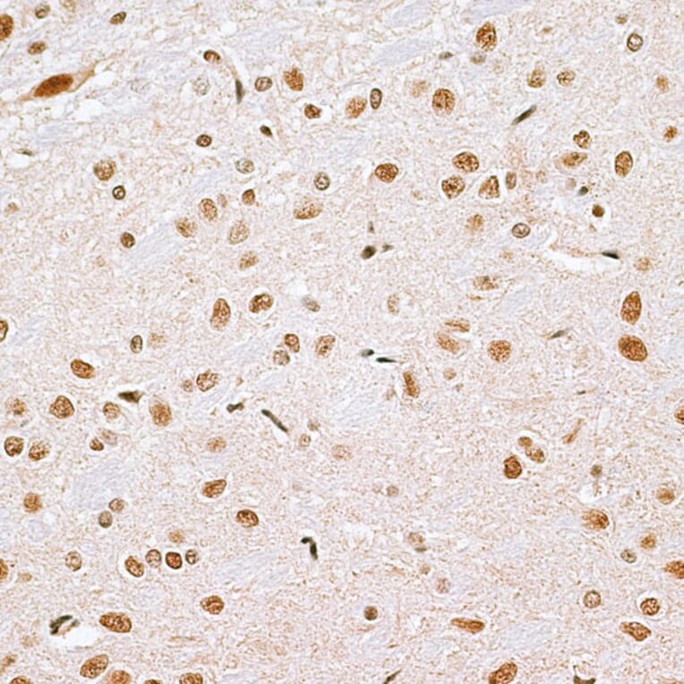 Immunohistochemistry - Anti-Cbx6 Antibody (A14823) - Antibodies.com