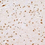 Immunohistochemistry - Anti-Cbx6 Antibody (A14823) - Antibodies.com