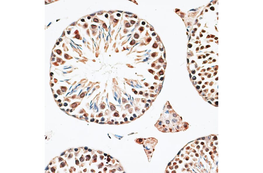 Immunohistochemistry - Anti-Cbx6 Antibody (A14823) - Antibodies.com