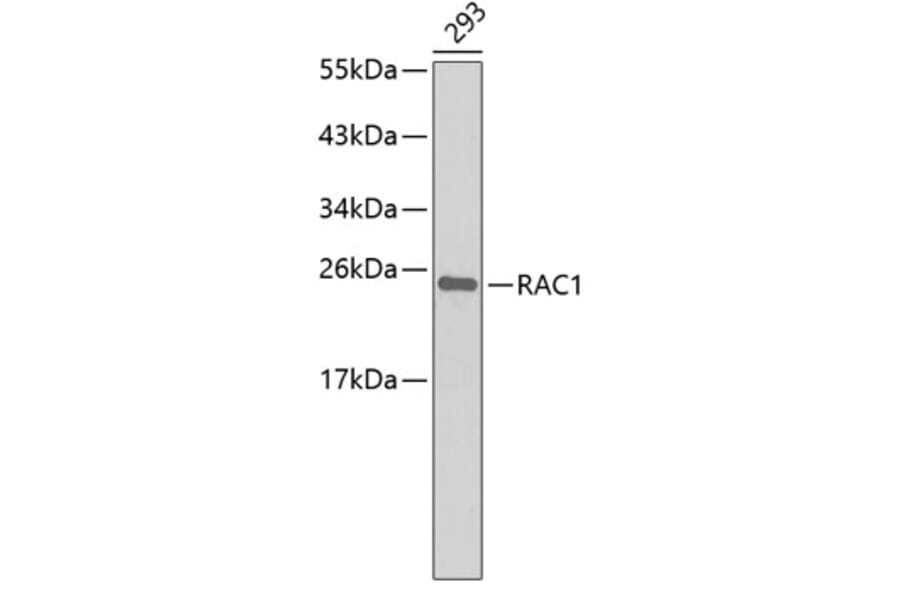 Western Blot - Anti-RAC1 Antibody (A5539) - Antibodies.com
