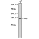 Western Blot - Anti-RAC1 Antibody (A5539) - Antibodies.com