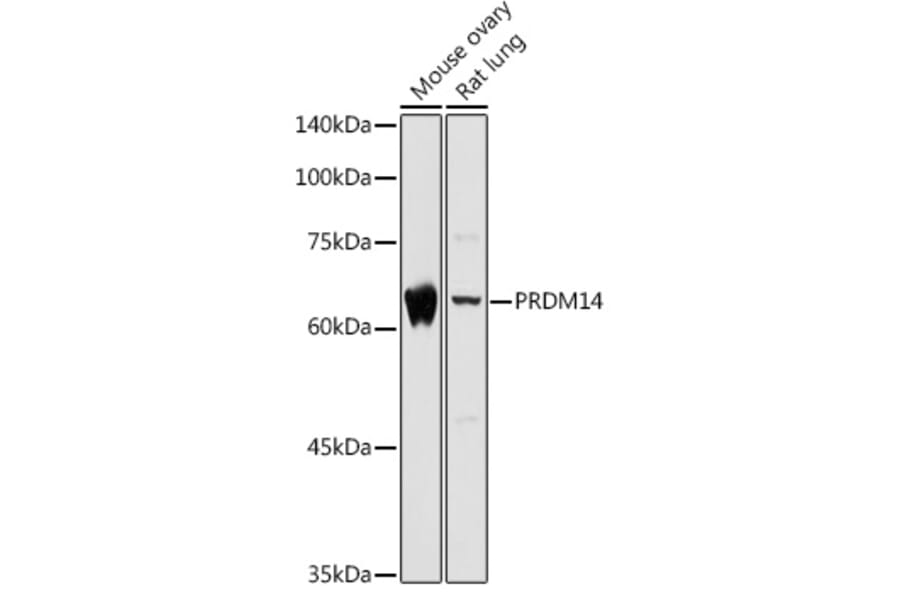 Western Blot - Anti-PRDM14 Antibody (A14825) - Antibodies.com