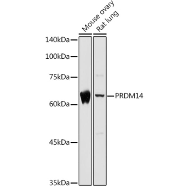 Western Blot - Anti-PRDM14 Antibody (A14825) - Antibodies.com
