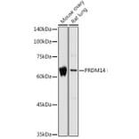 Western Blot - Anti-PRDM14 Antibody (A14825) - Antibodies.com