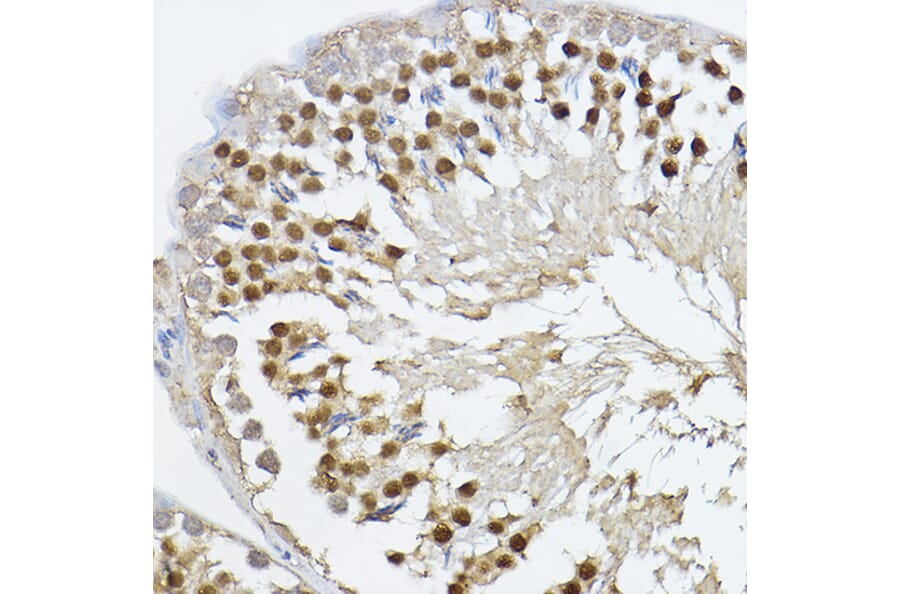 Immunohistochemistry - Anti-PRDM14 Antibody (A14825) - Antibodies.com