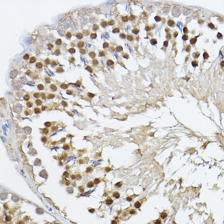 Immunohistochemistry - Anti-PRDM14 Antibody (A14825) - Antibodies.com