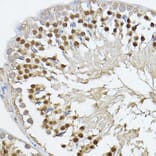 Immunohistochemistry - Anti-PRDM14 Antibody (A14825) - Antibodies.com