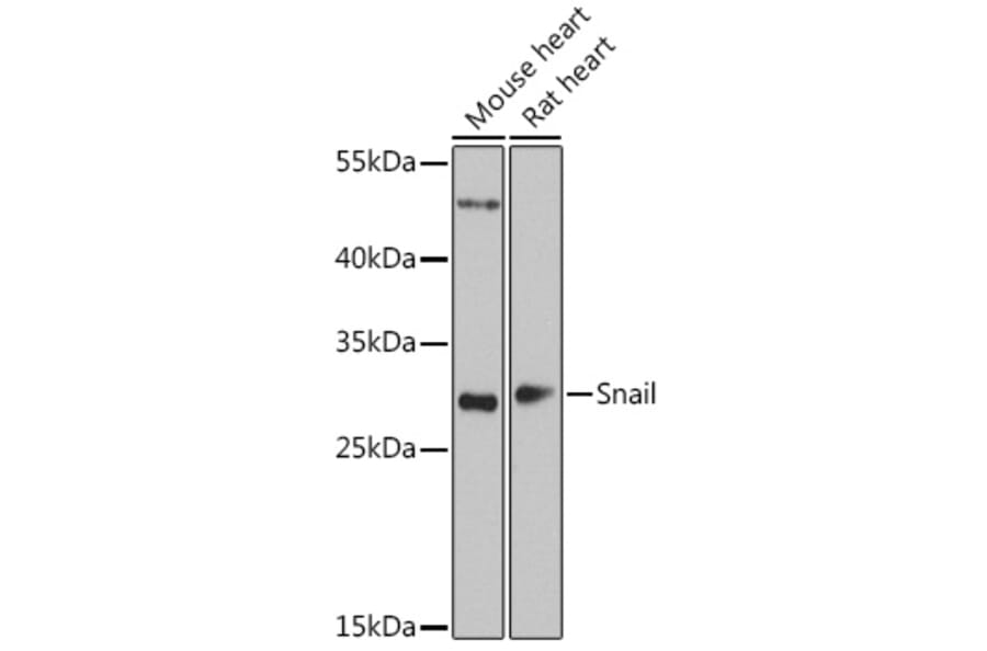 Western Blot - Anti-SNAIL Antibody (A14826) - Antibodies.com