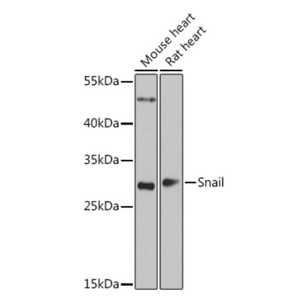 Western Blot - Anti-SNAIL Antibody (A14826) - Antibodies.com