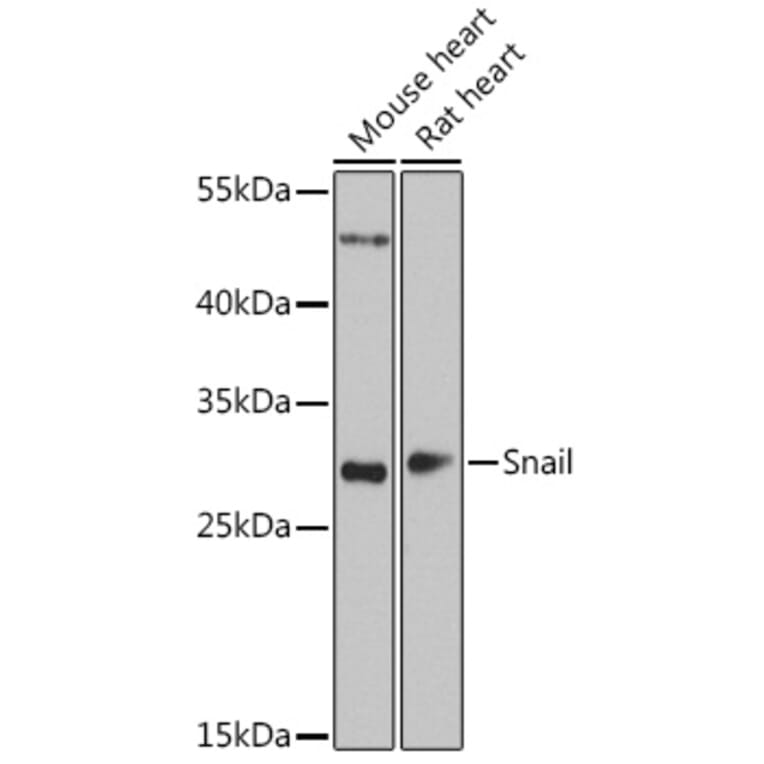 Western Blot - Anti-SNAIL Antibody (A14826) - Antibodies.com