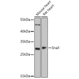 Western Blot - Anti-SNAIL Antibody (A14826) - Antibodies.com