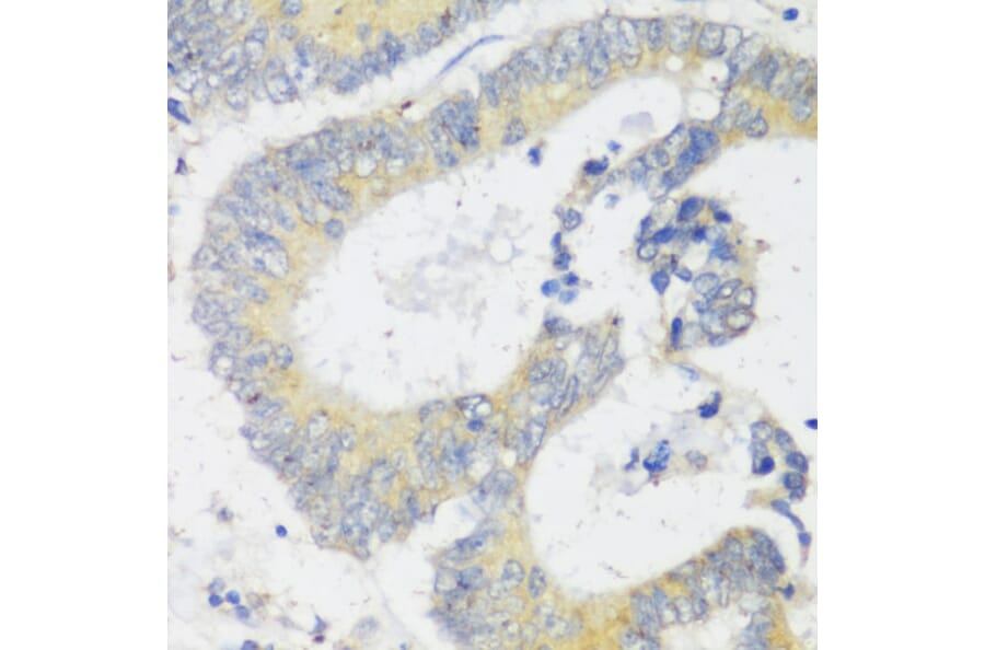 Immunohistochemistry - Anti-SNAIL Antibody (A14826) - Antibodies.com