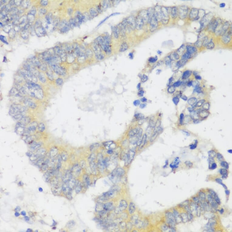 Immunohistochemistry - Anti-SNAIL Antibody (A14826) - Antibodies.com