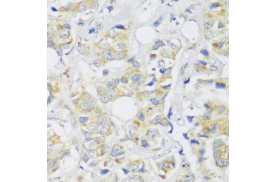 Immunohistochemistry - Anti-SNAIL Antibody (A14826) - Antibodies.com