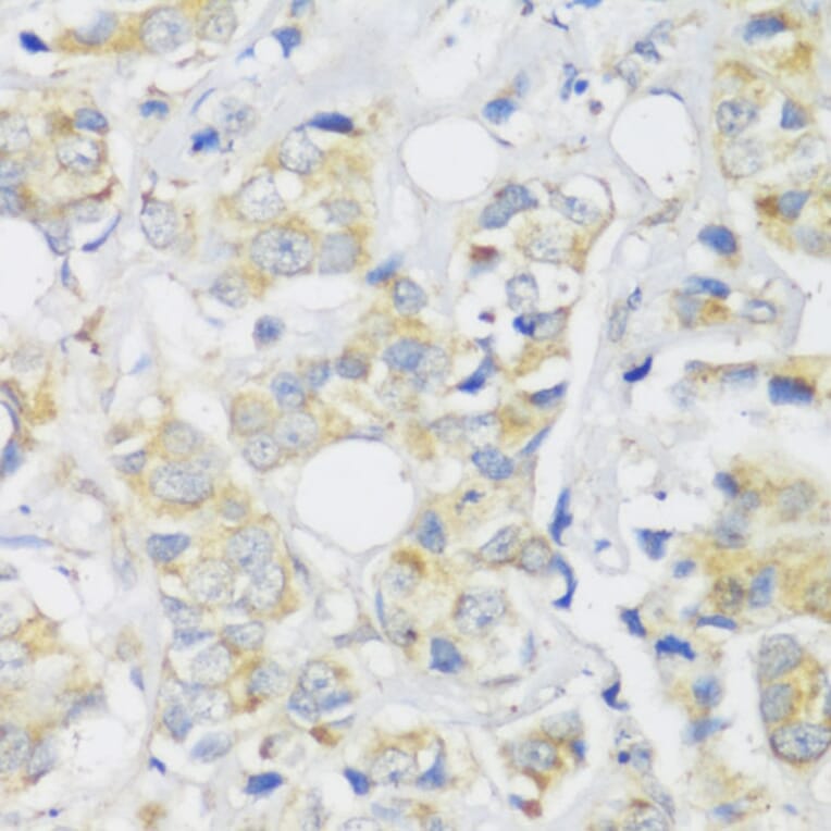Immunohistochemistry - Anti-SNAIL Antibody (A14826) - Antibodies.com