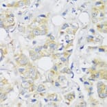 Immunohistochemistry - Anti-SNAIL Antibody (A14826) - Antibodies.com