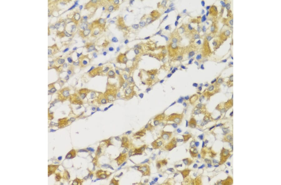 Immunohistochemistry - Anti-SNAIL Antibody (A14826) - Antibodies.com