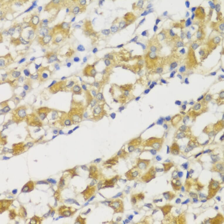Immunohistochemistry - Anti-SNAIL Antibody (A14826) - Antibodies.com