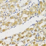 Immunohistochemistry - Anti-SNAIL Antibody (A14826) - Antibodies.com
