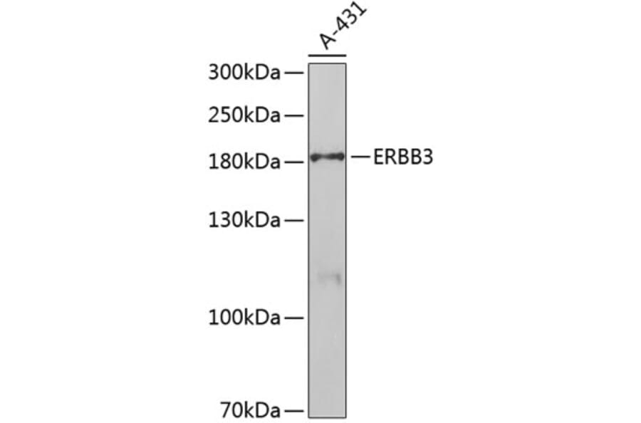 Western Blot - Anti-ERBB3 Antibody (A5545) - Antibodies.com