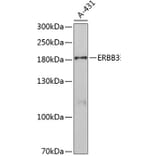 Western Blot - Anti-ERBB3 Antibody (A5545) - Antibodies.com