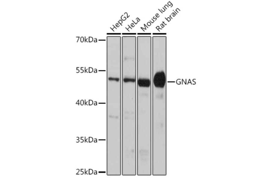 Western Blot - Anti-GNAS Antibody (A14828) - Antibodies.com