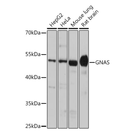 Western Blot - Anti-GNAS Antibody (A14828) - Antibodies.com