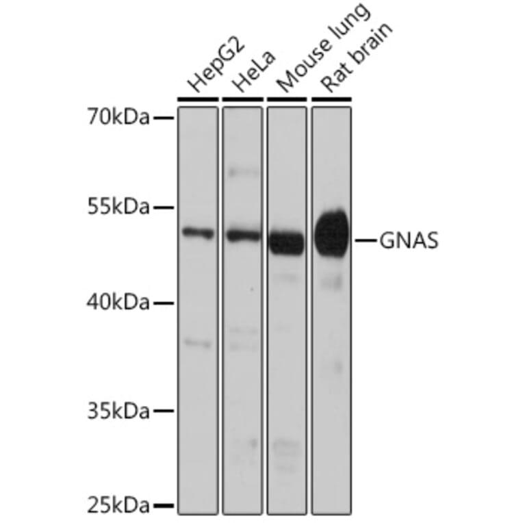 Western Blot - Anti-GNAS Antibody (A14828) - Antibodies.com