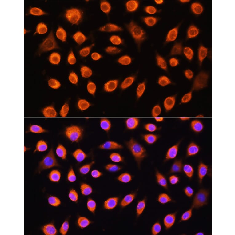 Immunofluorescence - Anti-GNAS Antibody (A14828) - Antibodies.com