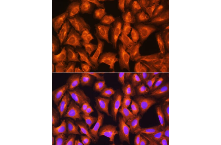Immunofluorescence - Anti-GNAS Antibody (A14828) - Antibodies.com