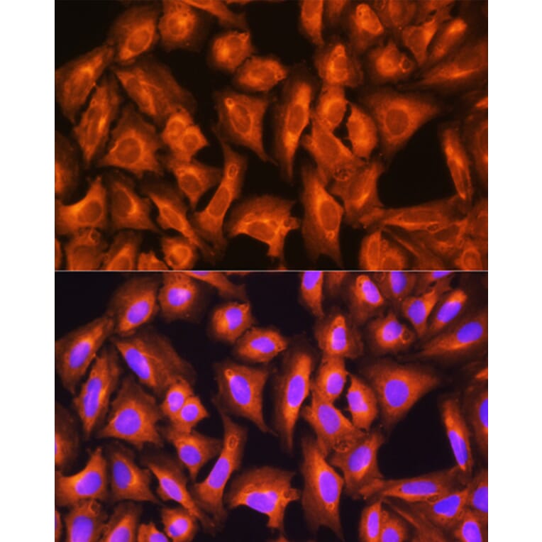 Immunofluorescence - Anti-GNAS Antibody (A14828) - Antibodies.com