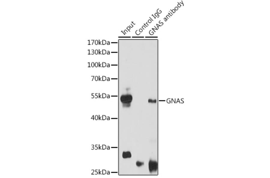 Western Blot - Anti-GNAS Antibody (A14828) - Antibodies.com