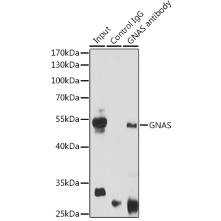 Western Blot - Anti-GNAS Antibody (A14828) - Antibodies.com