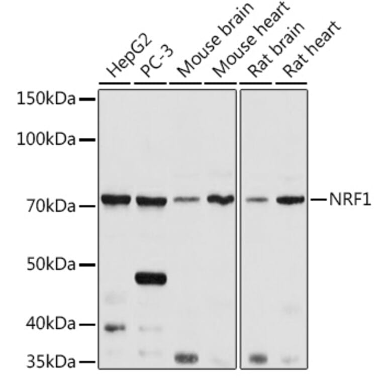 Western Blot - Anti-NRF1 Antibody (A14829) - Antibodies.com