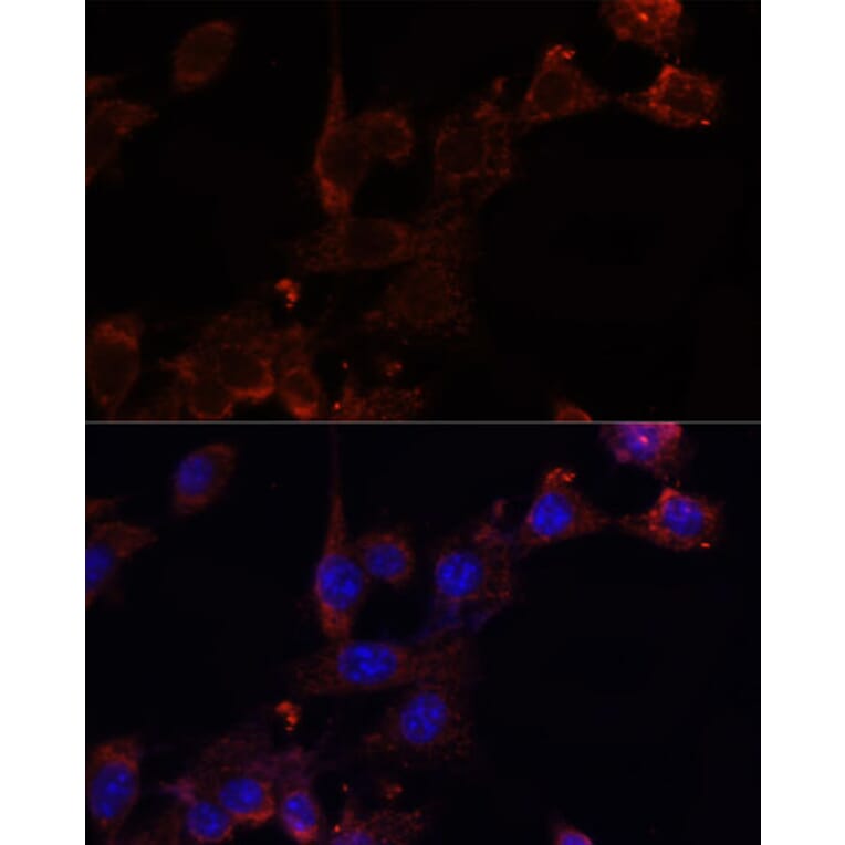 Chromatin Immunoprecipitation - Anti-NRF1 Antibody (A14829) - Antibodies.com