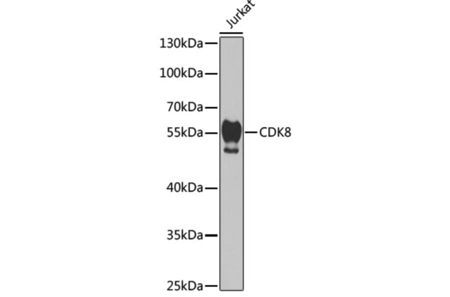 Western Blot - Anti-Cdk8 Antibody (A14830) - Antibodies.com