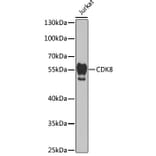 Western Blot - Anti-Cdk8 Antibody (A14830) - Antibodies.com