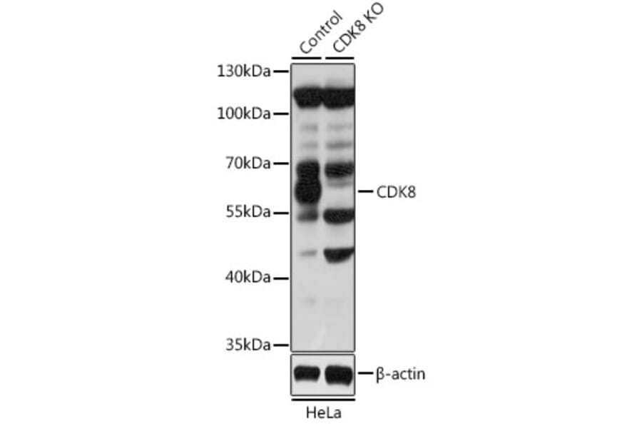 Western Blot - Anti-Cdk8 Antibody (A14830) - Antibodies.com