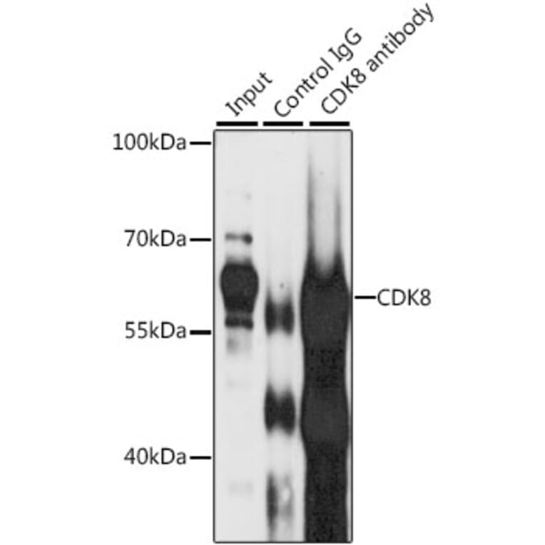 Western Blot - Anti-Cdk8 Antibody (A14830) - Antibodies.com