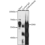 Western Blot - Anti-Cdk8 Antibody (A14830) - Antibodies.com