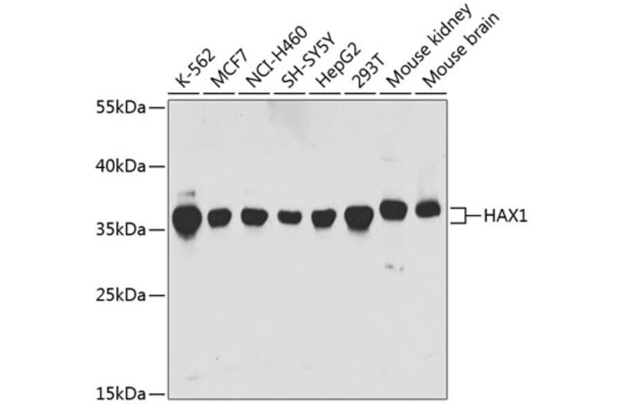 Western Blot - Anti-HAX1 Antibody (A14832) - Antibodies.com