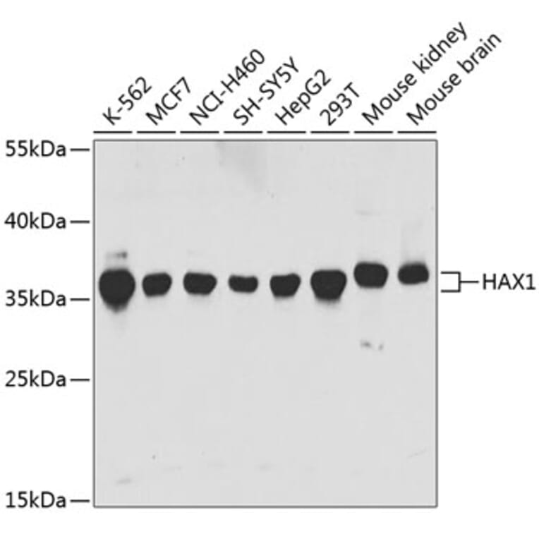 Western Blot - Anti-HAX1 Antibody (A14832) - Antibodies.com